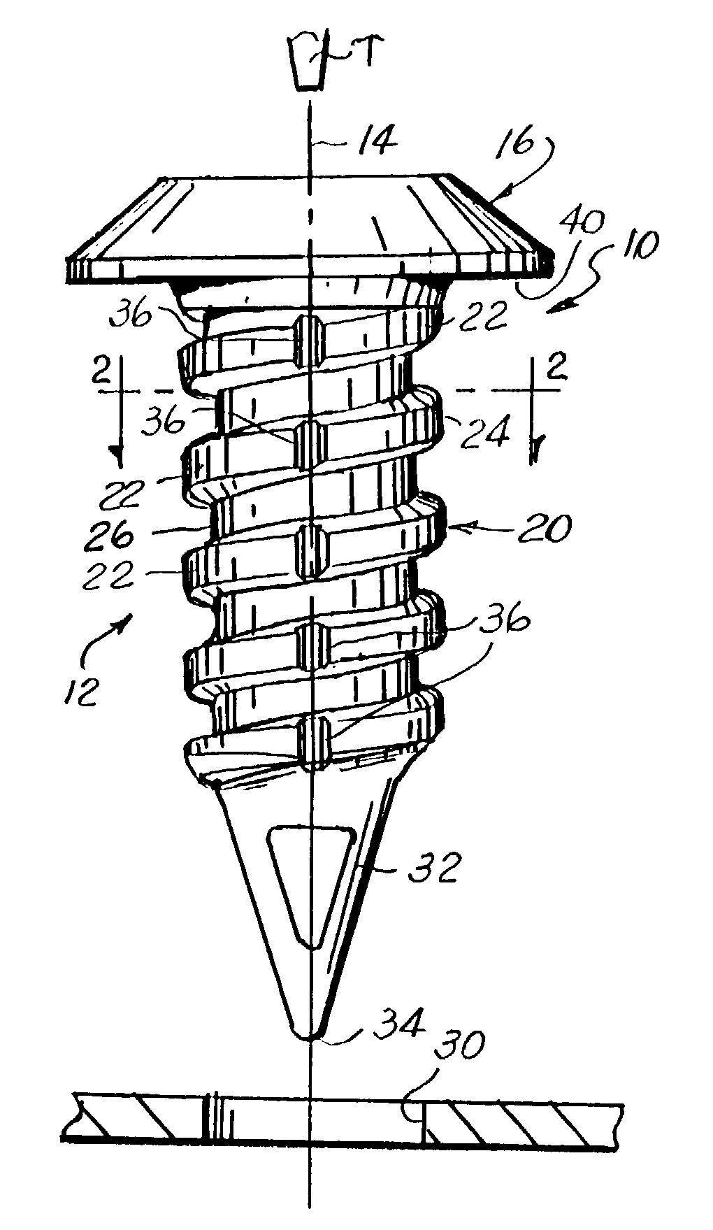 Push-in removable fastener