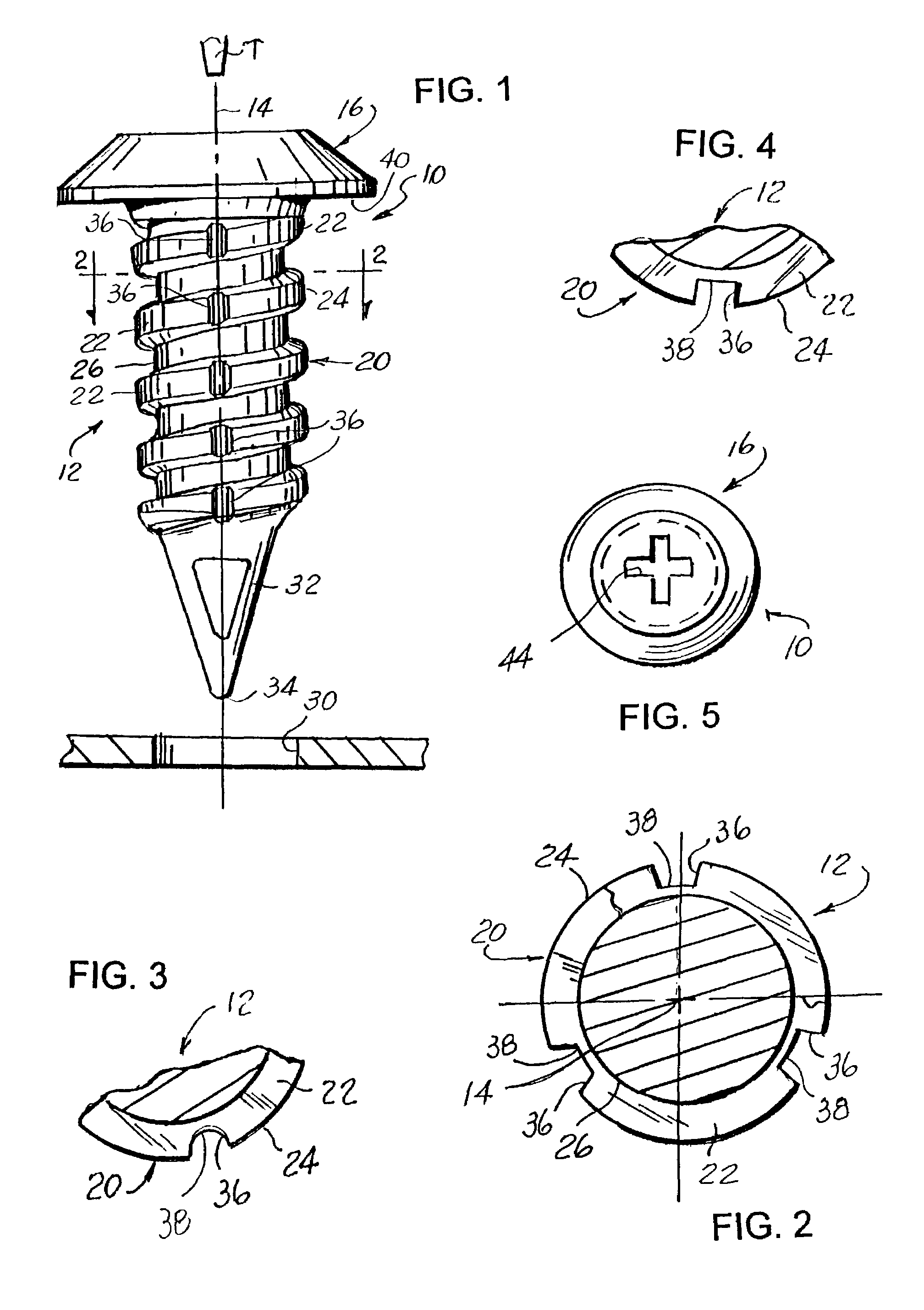 Push-in removable fastener