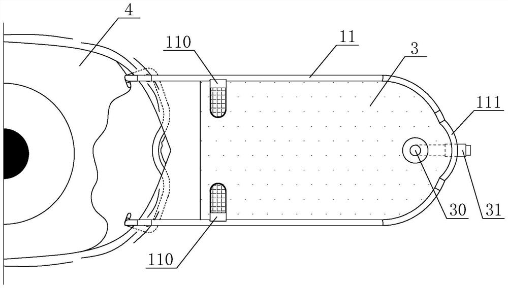 Intraoperative conjunctival sac drainage apparatus for ophthalmologic operation