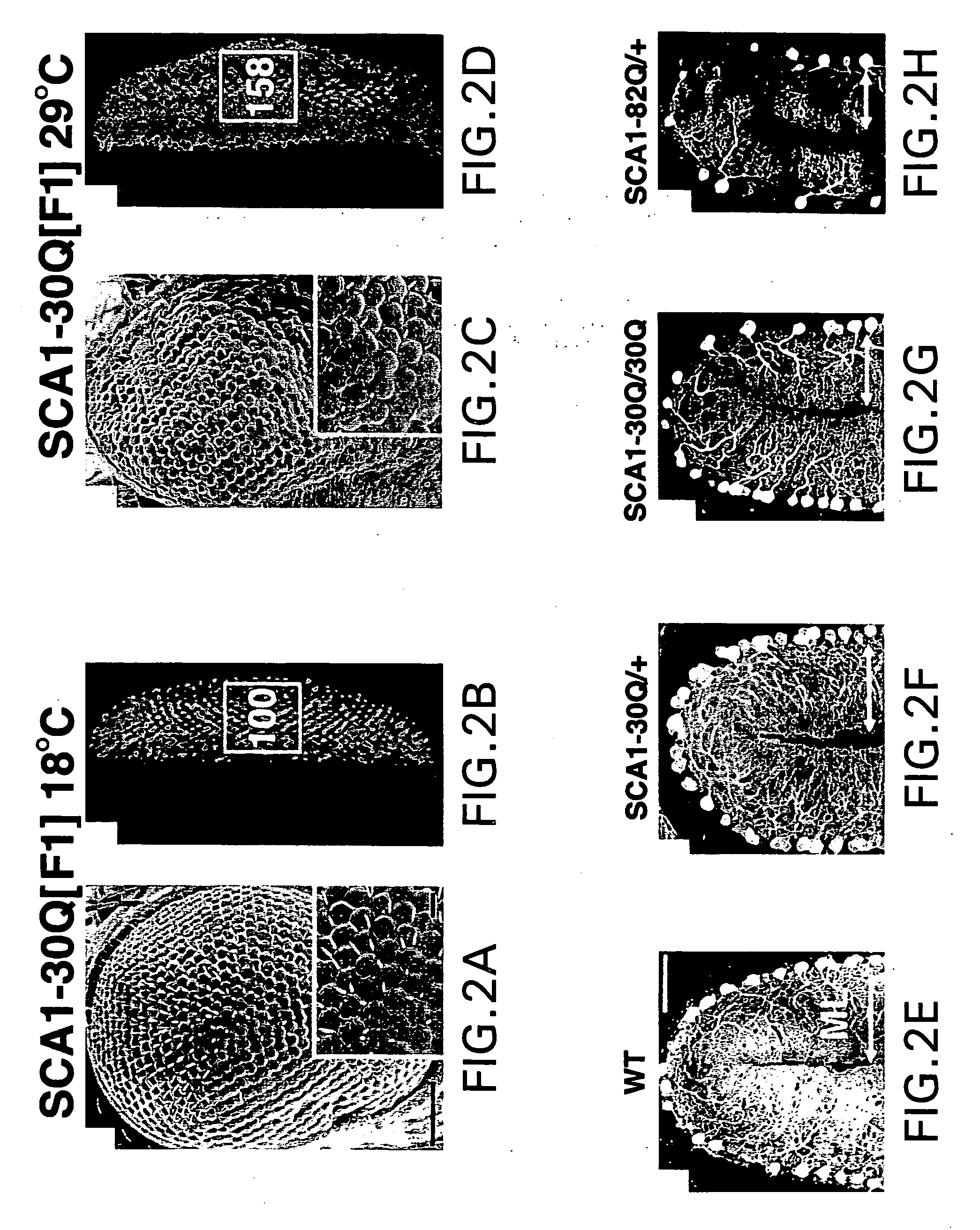 Methods and compositions for the identification and treatment of neurodegenerative disorders