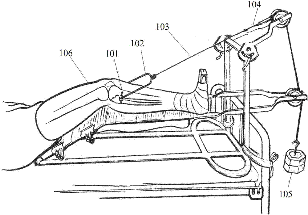 Skeletal traction acting force device