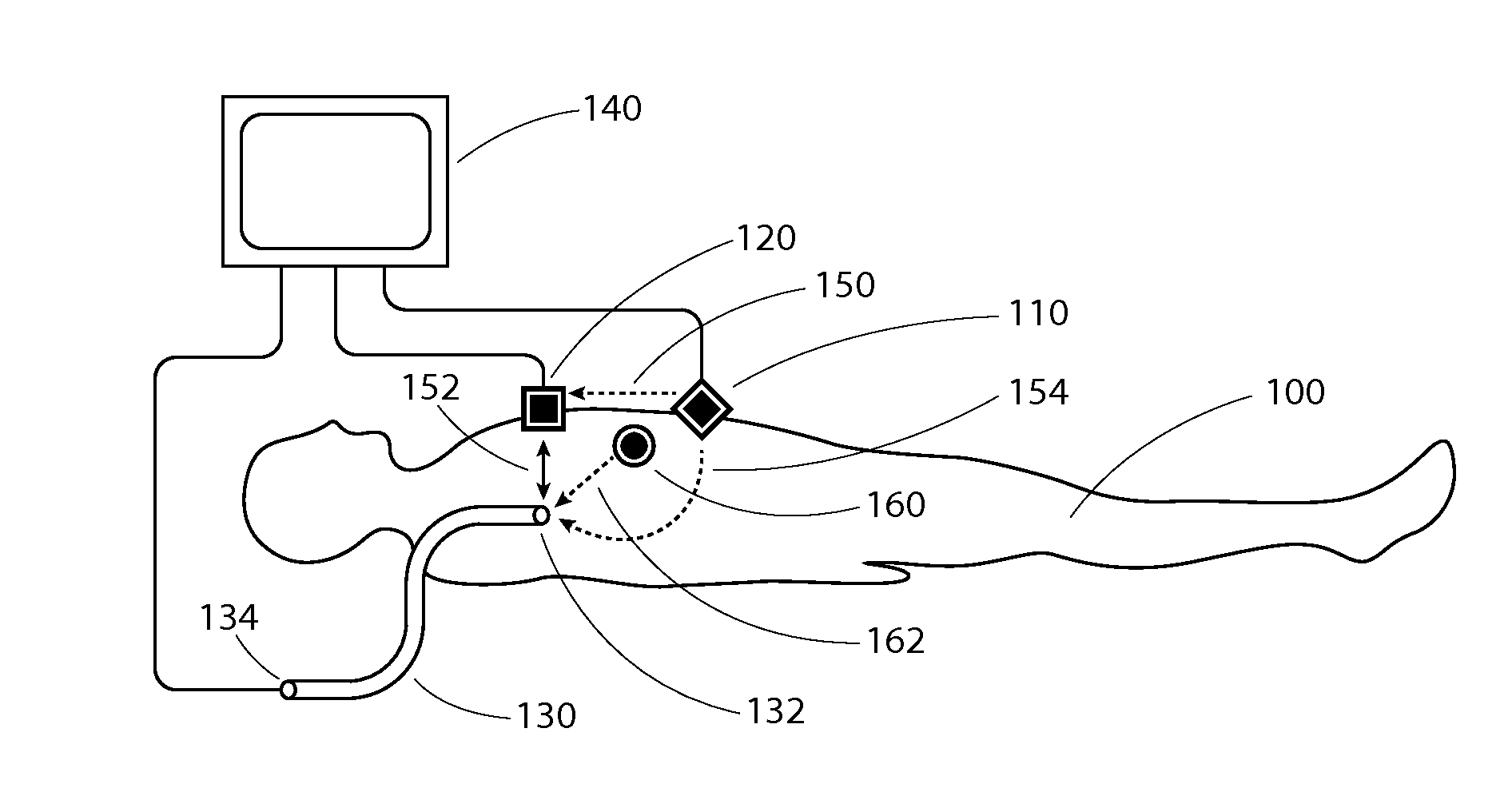 Apparatus and method for intravascular catheter navigation using the electrical conduction system of the heart and control electrodes