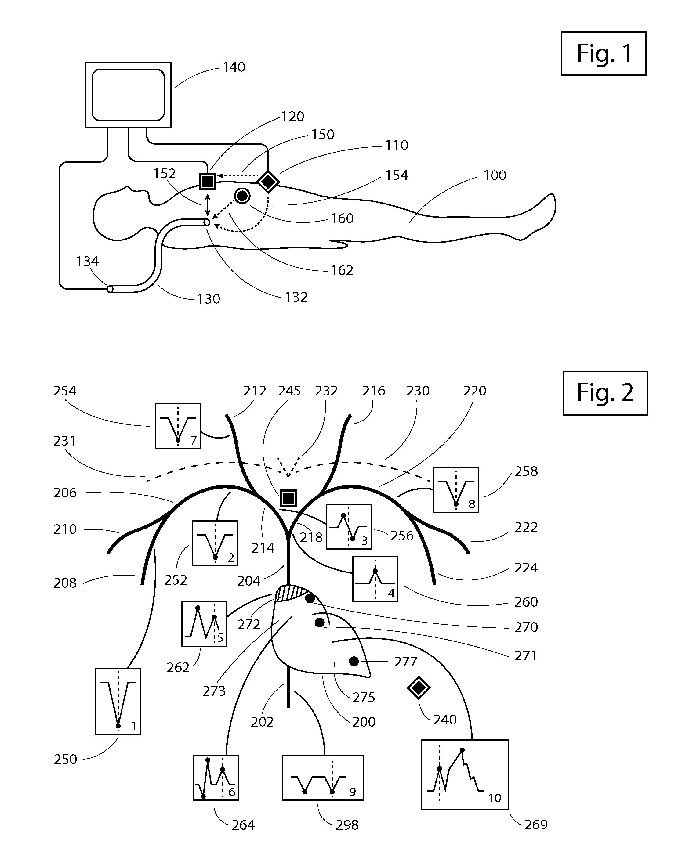 Apparatus and method for intravascular catheter navigation using the electrical conduction system of the heart and control electrodes