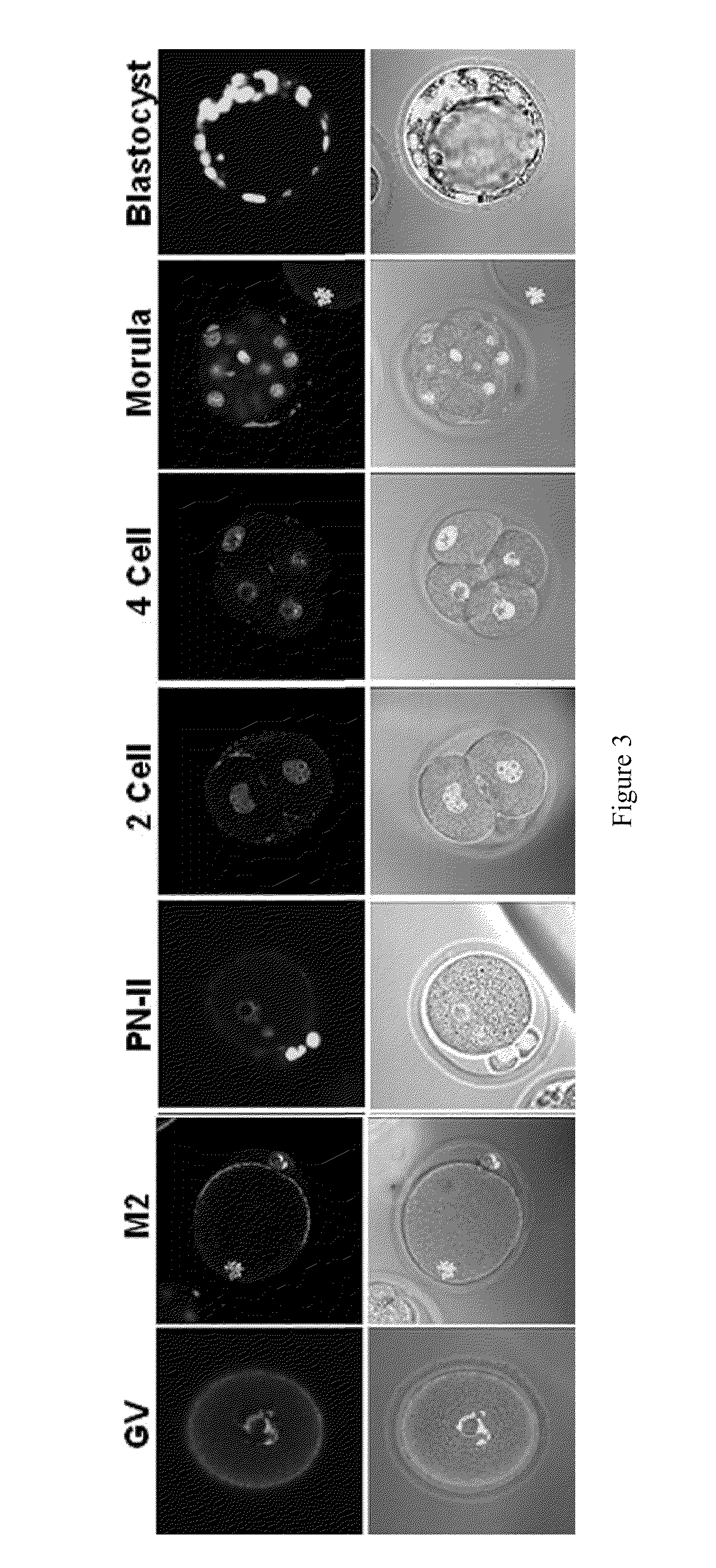 Compositions and methods for regulating sas1r