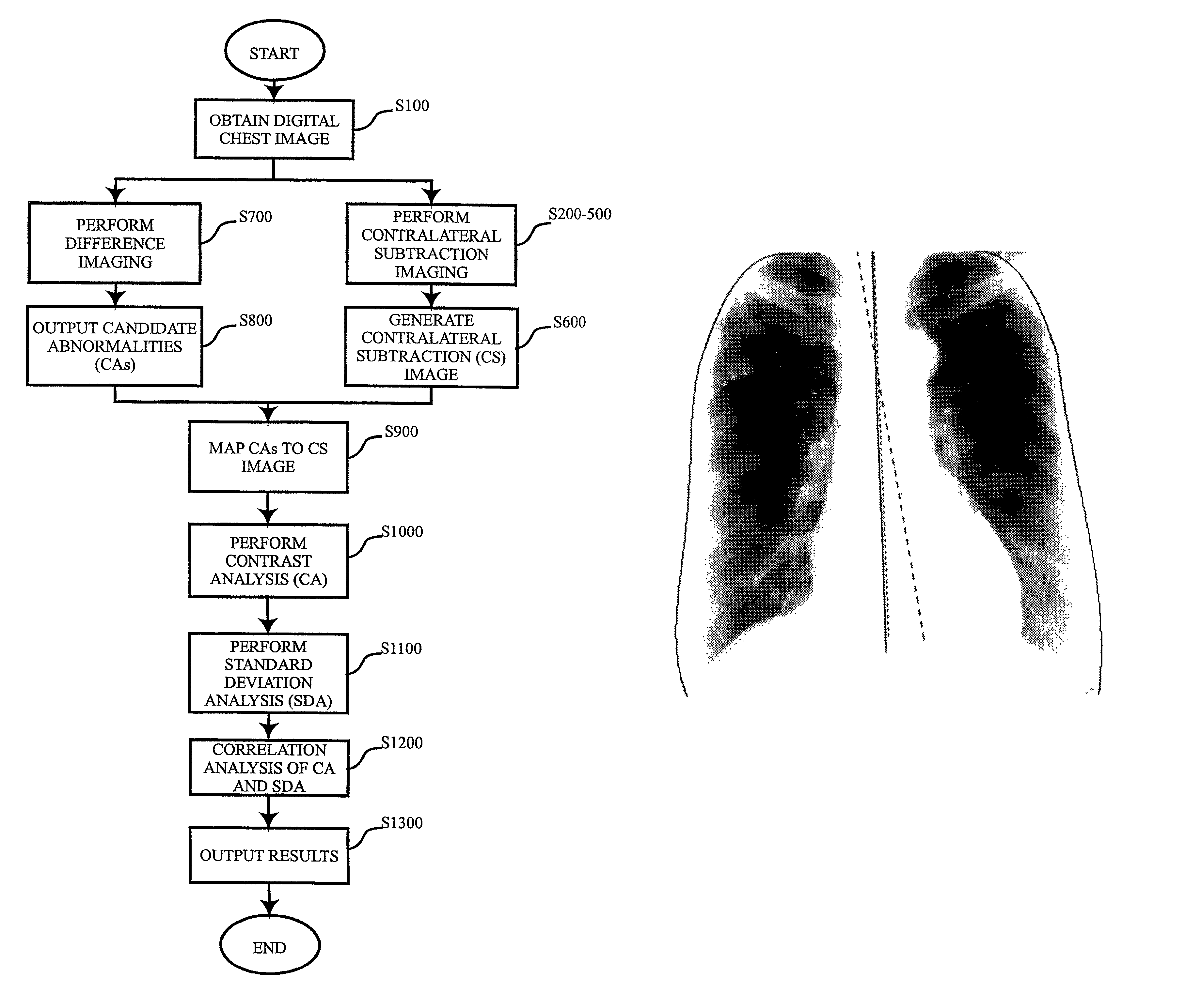 System for computerized processing of chest radiographic images