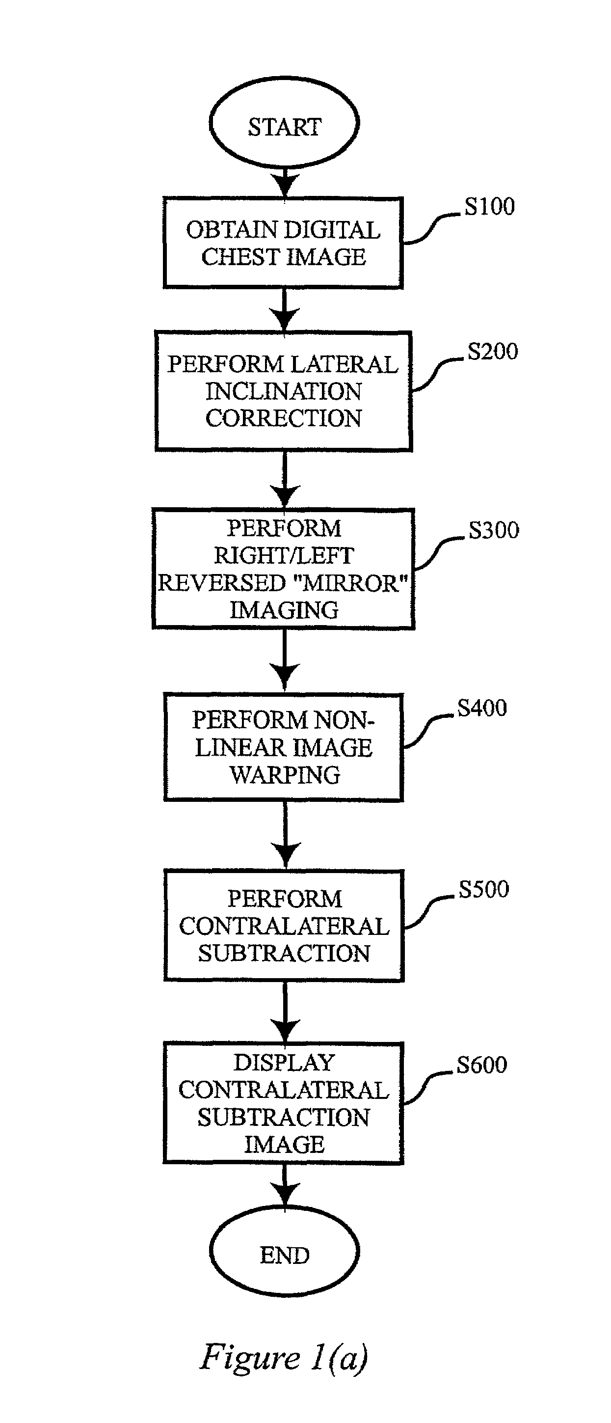 System for computerized processing of chest radiographic images