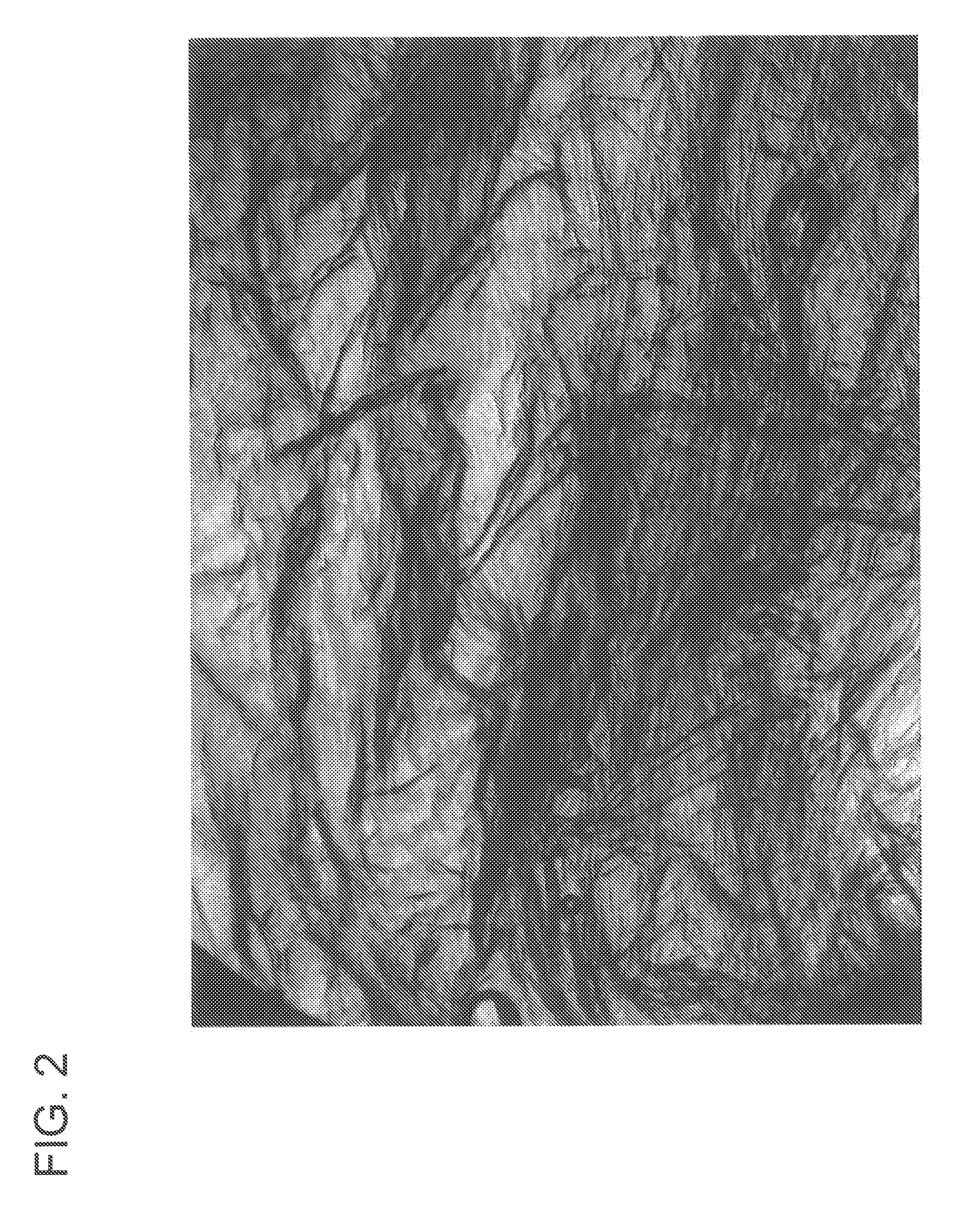 Processed Meat Products Comprising Structured Protein Products