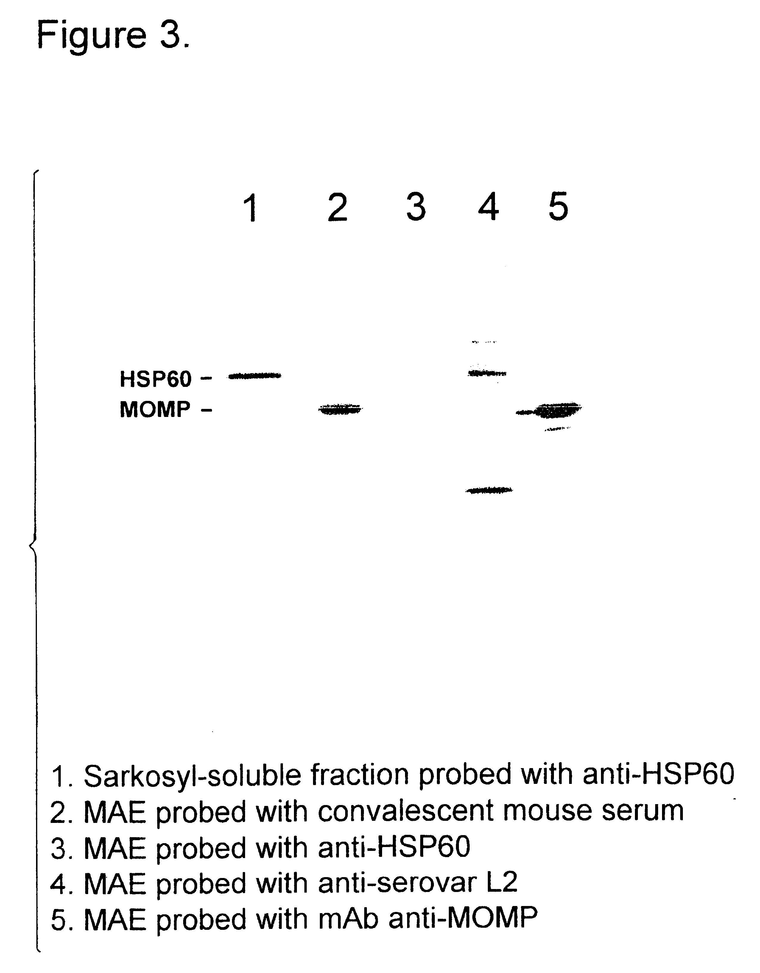 Chlamydial vaccines and immunogenic compositions containing an outer membrane antigen and methods of preparation thereof