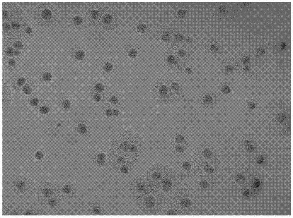 A kind of human mycoplasma pneumoniae culture medium and its diagnostic kit