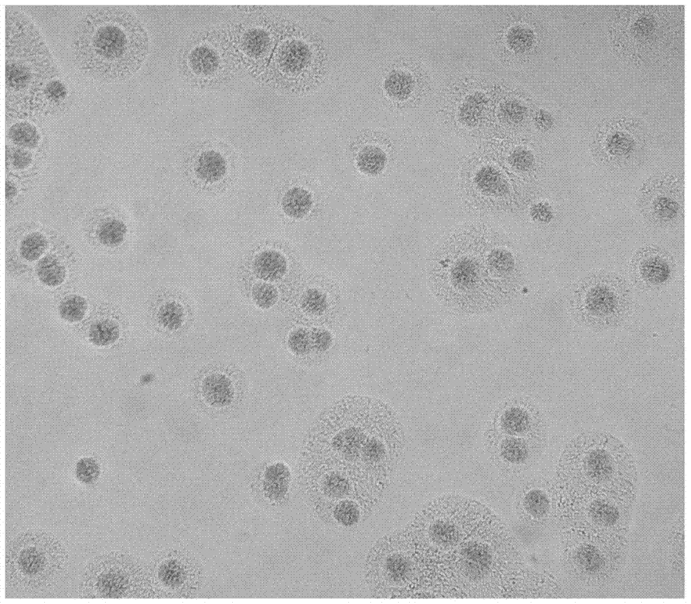 A kind of human mycoplasma pneumoniae culture medium and its diagnostic kit