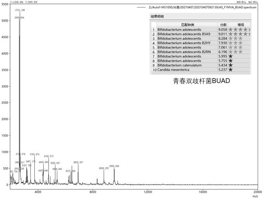 Bifidobacterium adolescentis and application thereof in metabolic syndrome