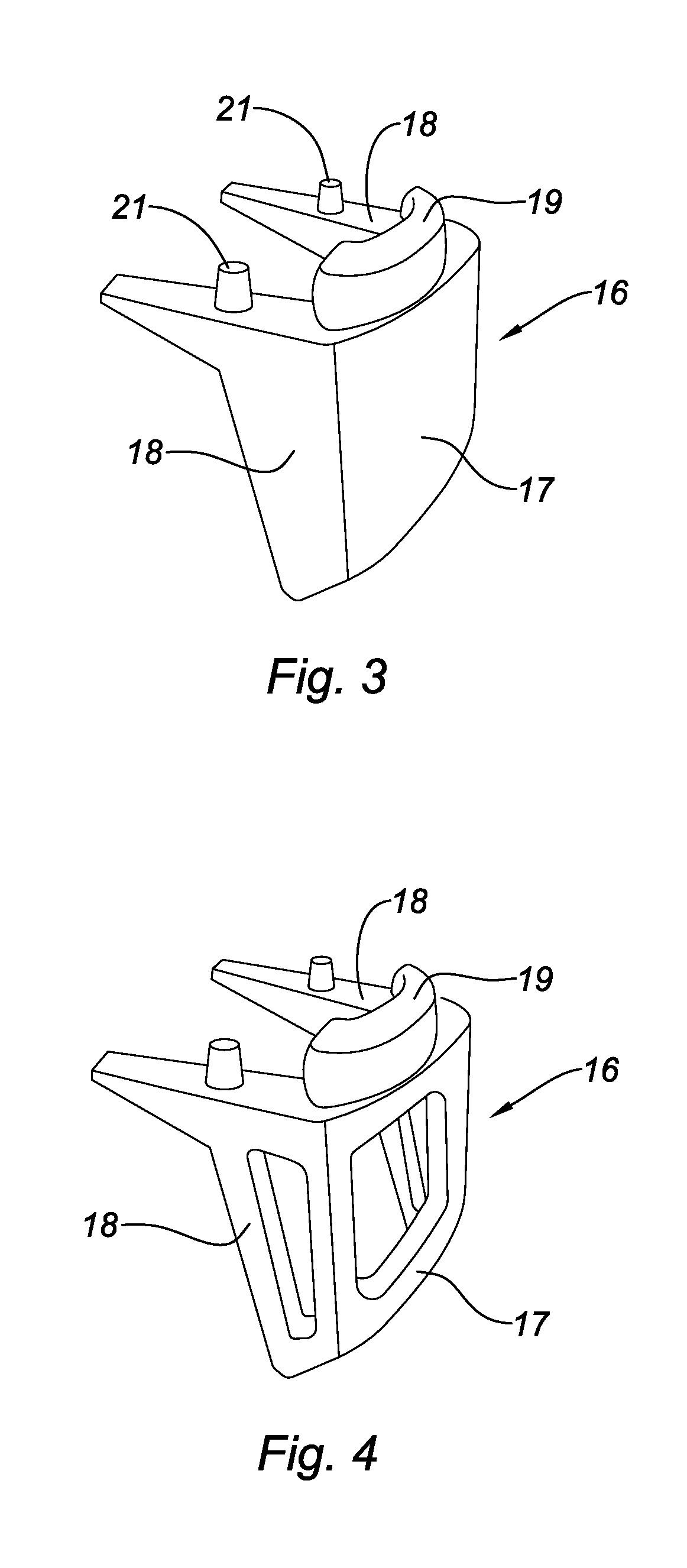 Hip prosthesis