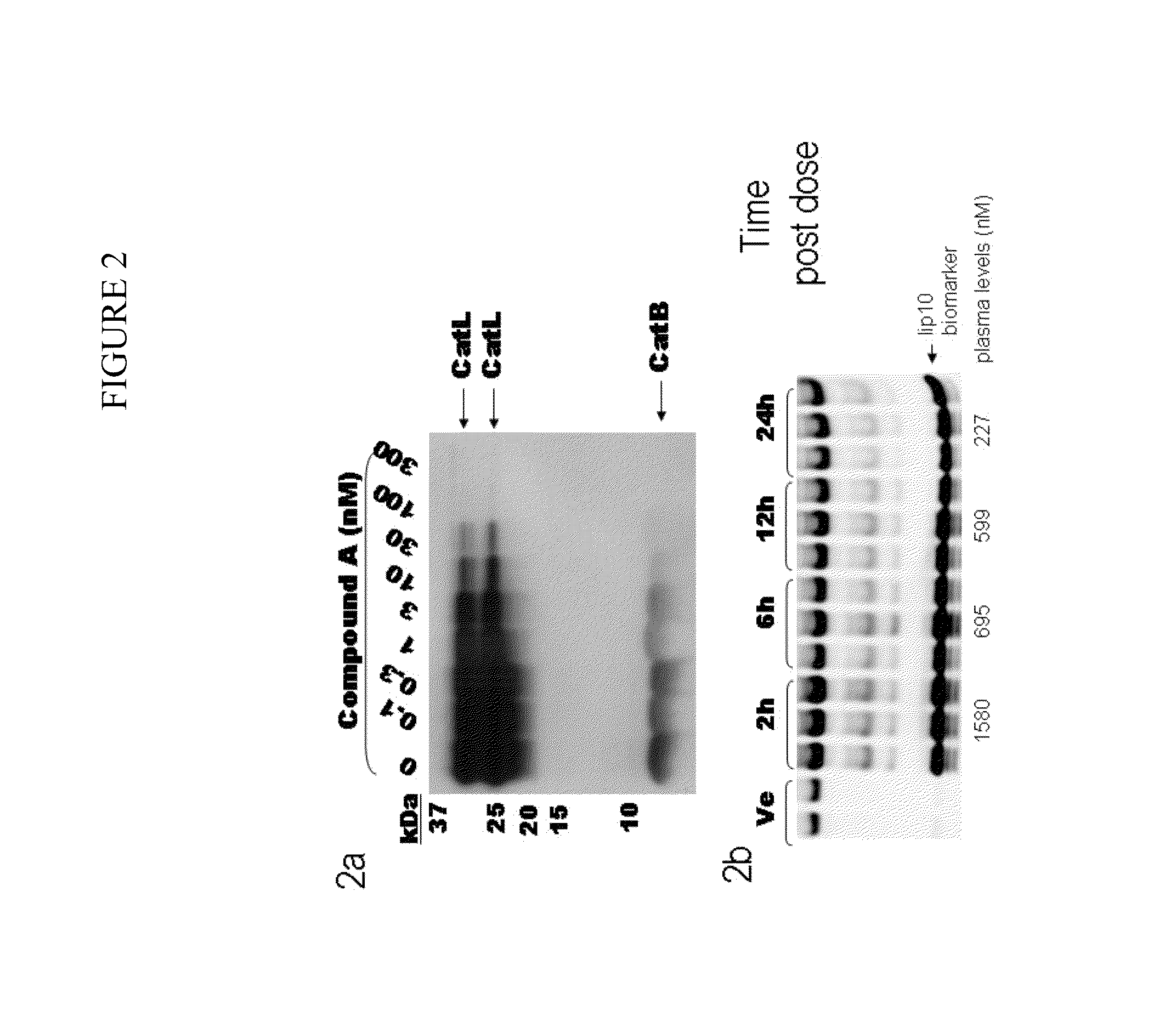Cathepsin inhibitors for the treatment of bone cancer and bone cancer pain