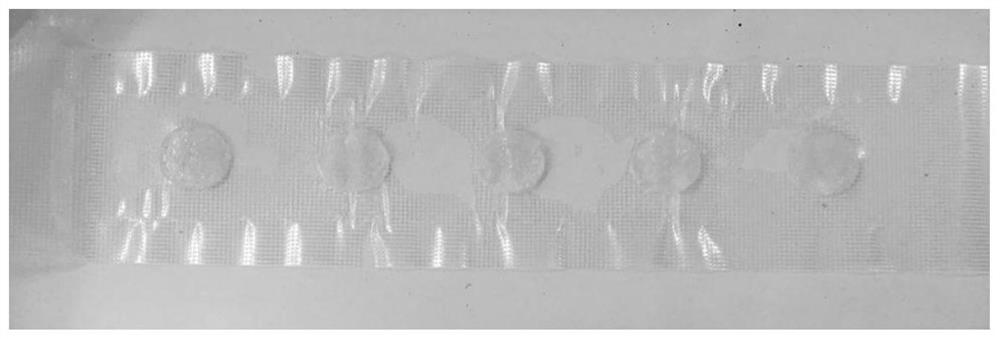 Pharmacosome hydrogel patch for GSH concentration responsive treatment of hyperthyroidism and preparation method thereof