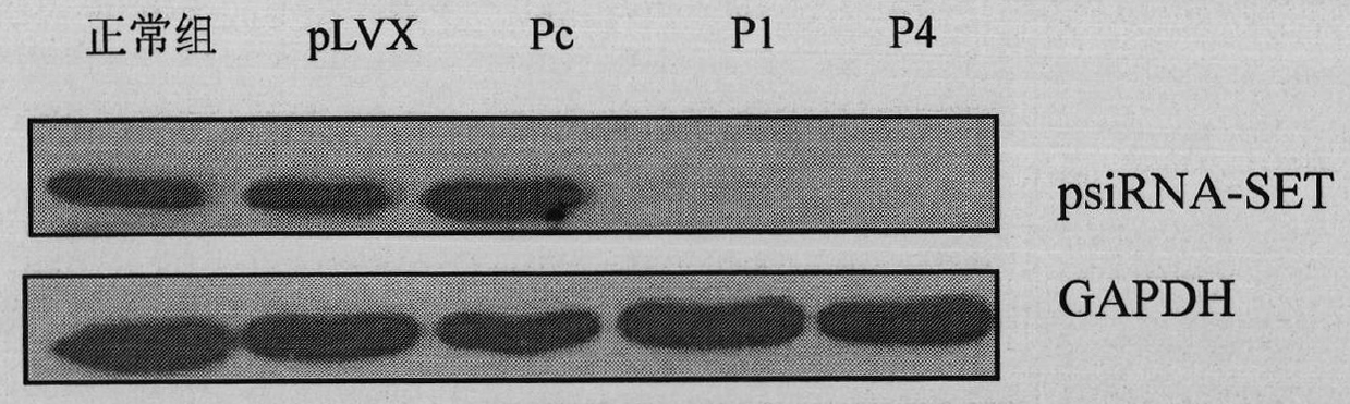 shRNA expression vector expressed by specificity inhibitor set protein, construction method and application thereof