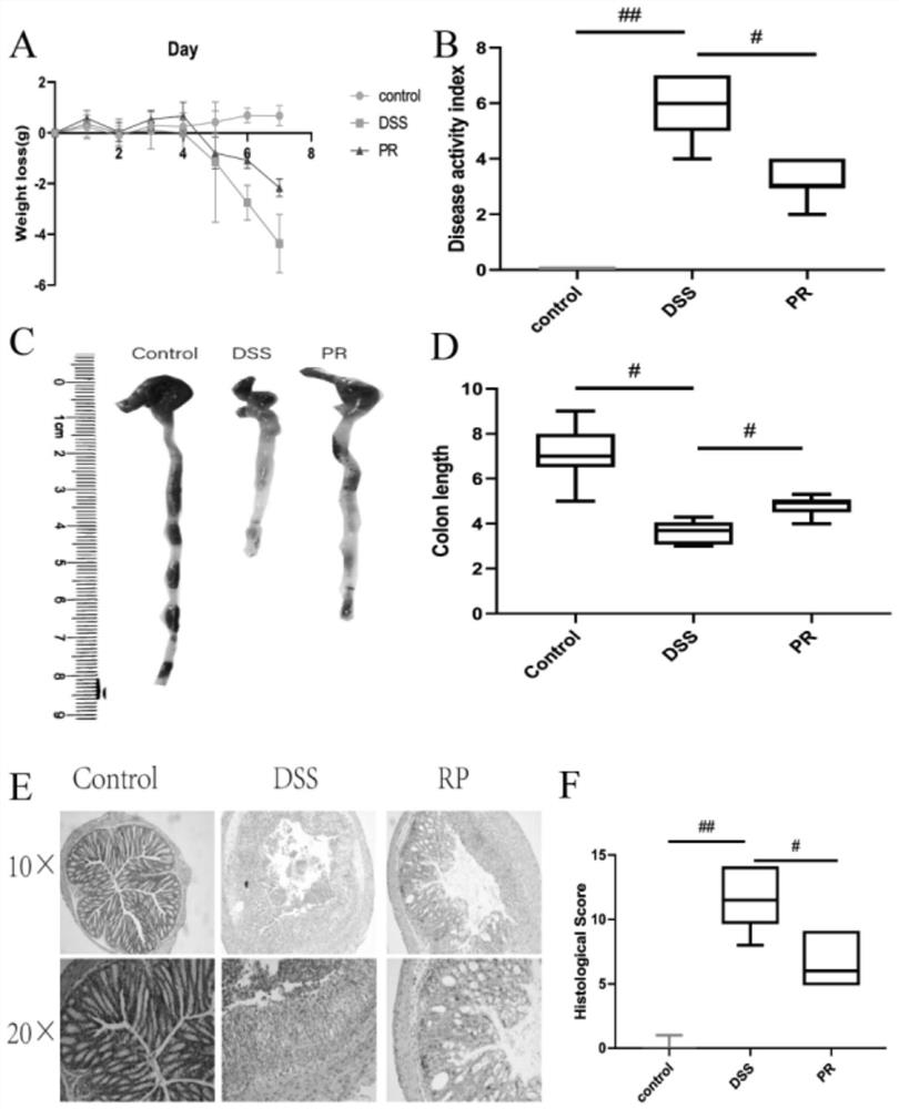 Pharmaceutical composition containing pulsatilla chinensis extract and application thereof