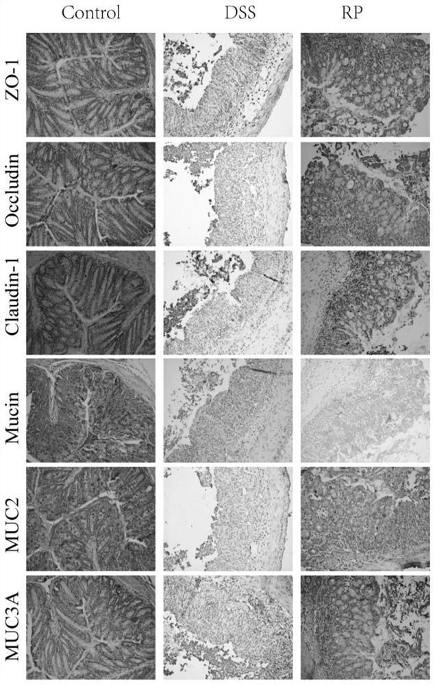 Pharmaceutical composition containing pulsatilla chinensis extract and application thereof