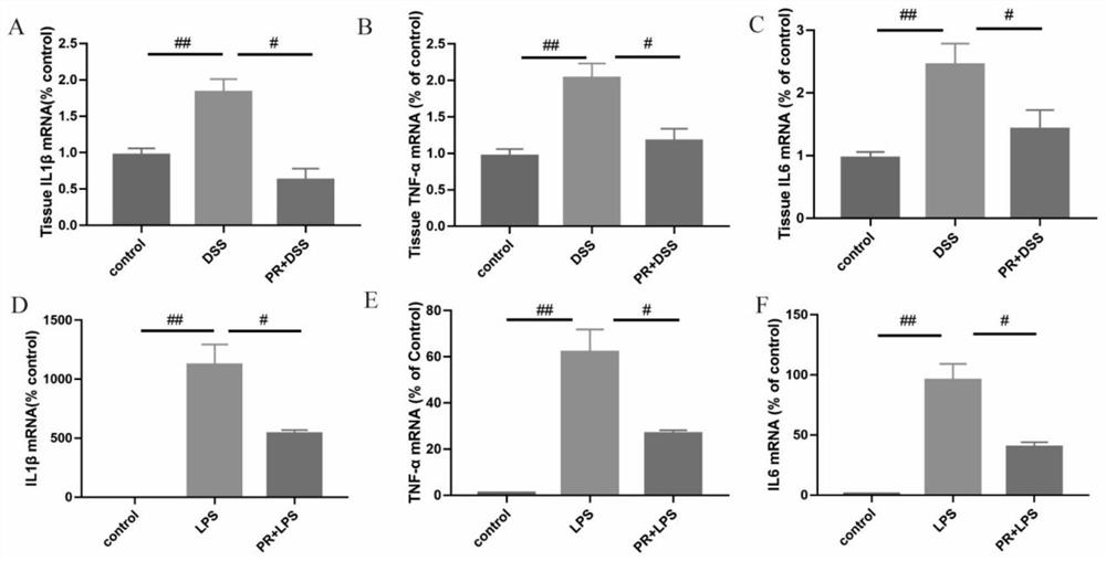 Pharmaceutical composition containing pulsatilla chinensis extract and application thereof