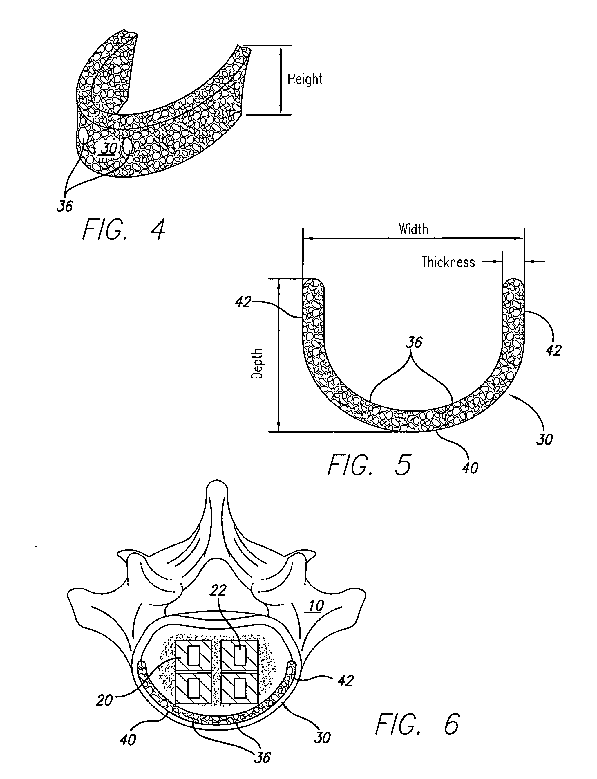 Support device for vertebral fusion