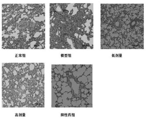 Application of Huangqi Shengmai Decoction in the preparation of pulmonary arterial hypertension medicine