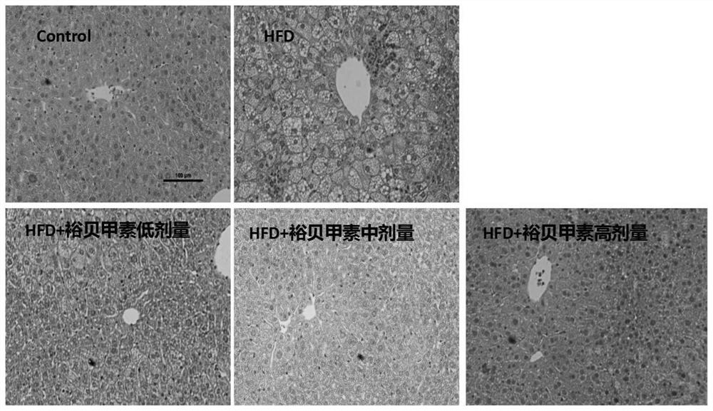 Application of Yubeijialin in the preparation of drugs for the prevention or treatment of non-alcoholic fatty liver disease