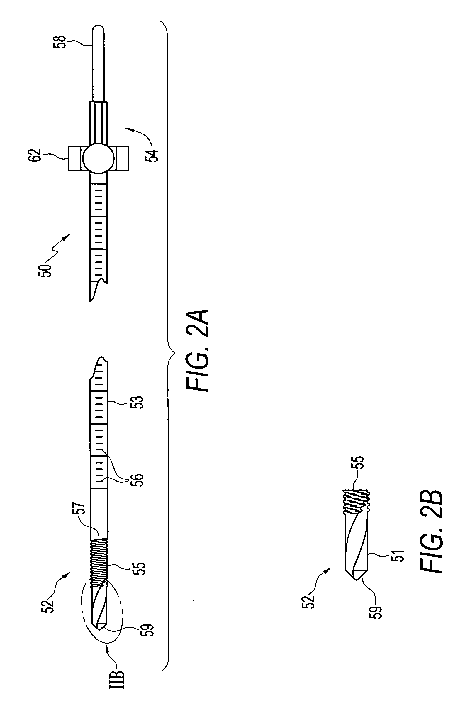 Retrodrill technique for insertion of autograft, allograft or synthetic osteochondral implants