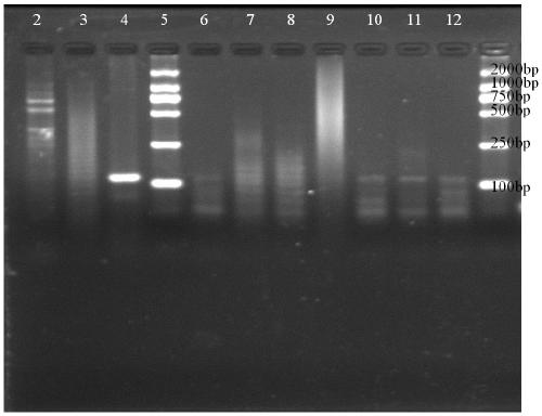 Detection method for determining pregnancy of sow by using sow urine