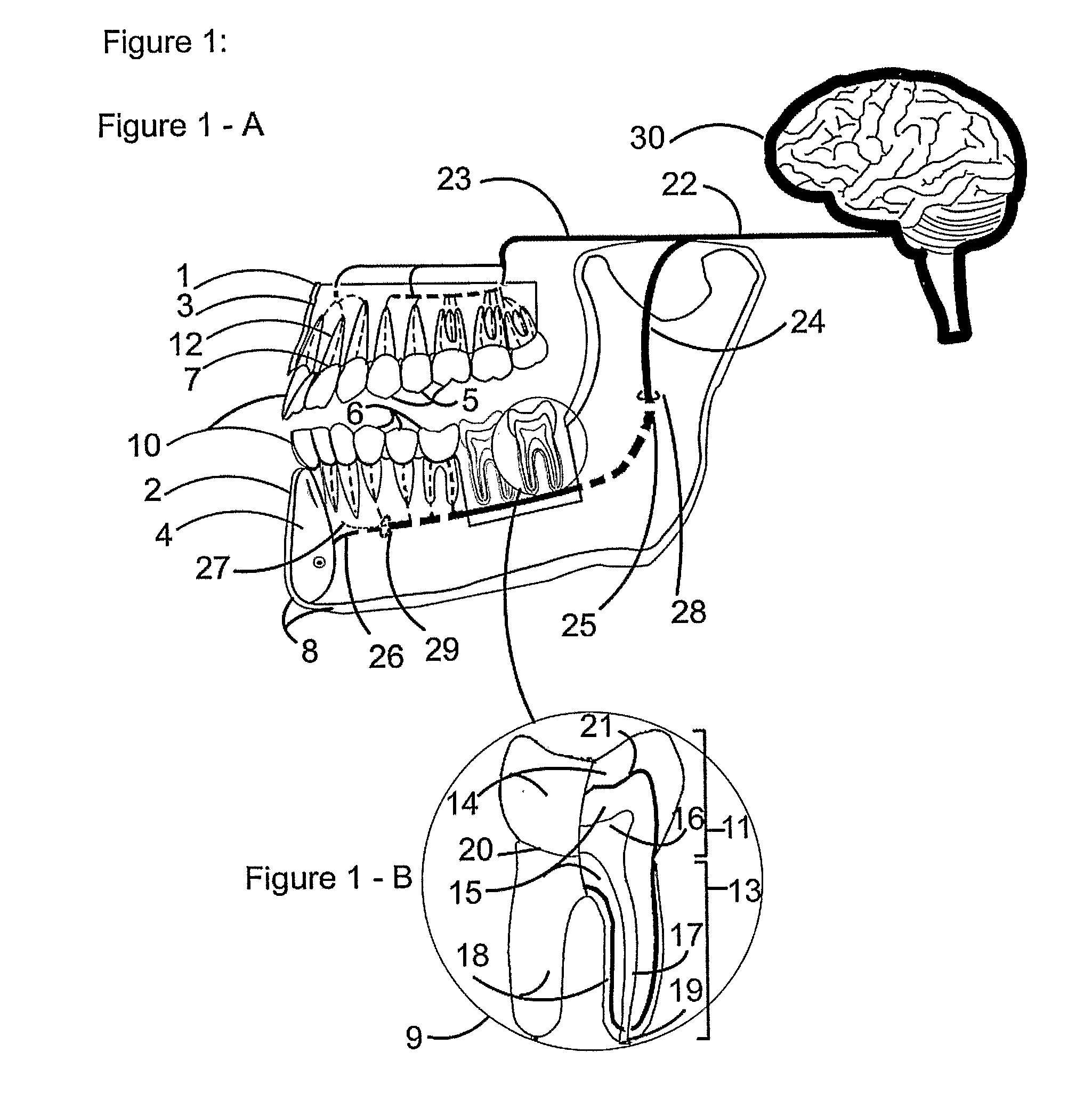 Method and a device for practicing dental treatments