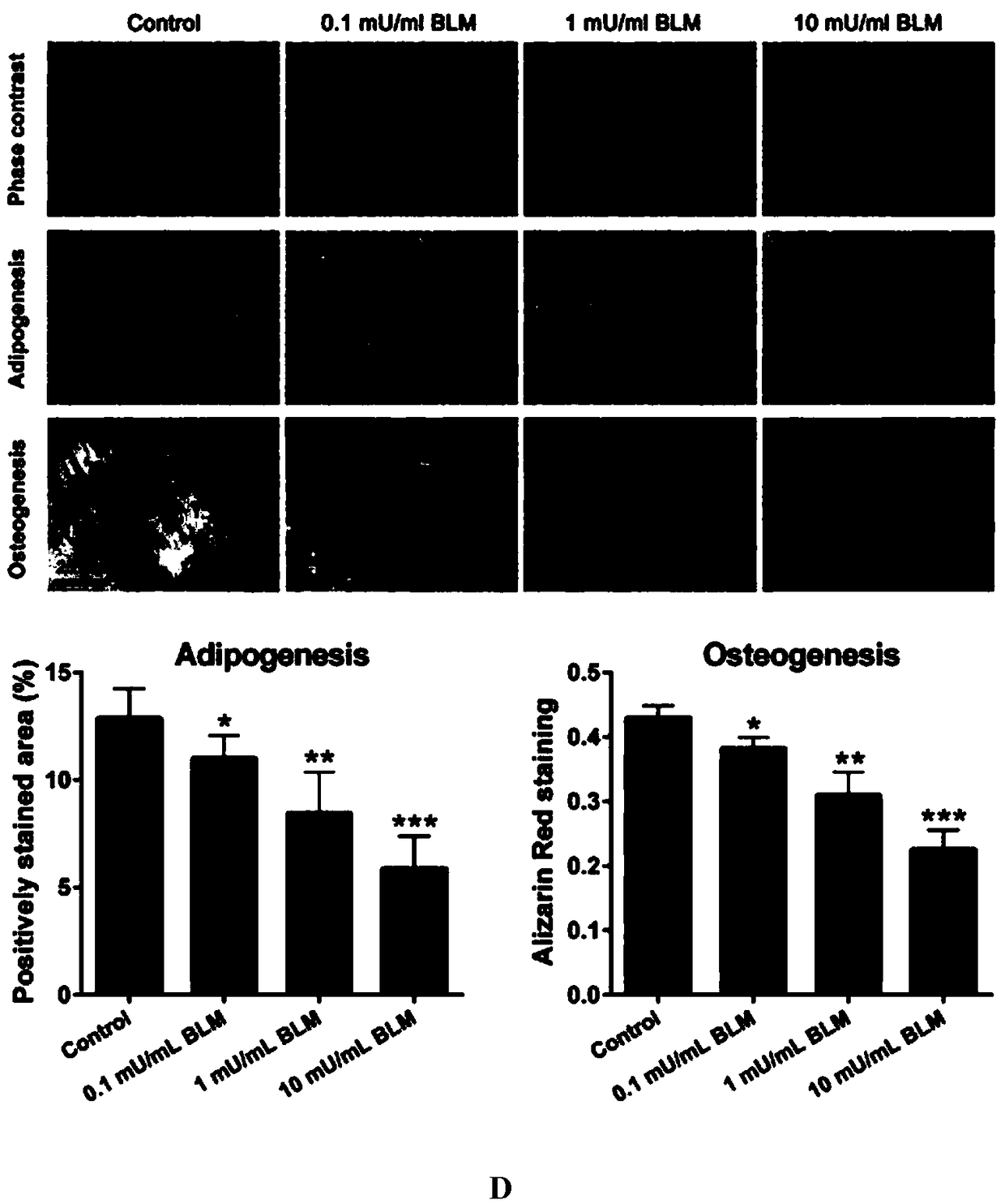 Application of bleomycin to preparation of medicines for restraining tooth eruption