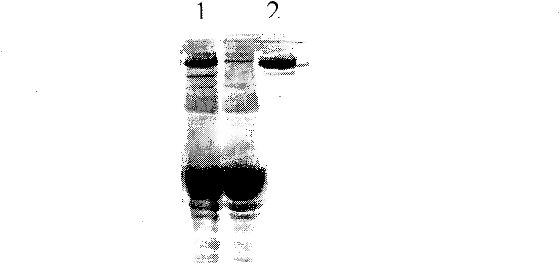 HAb18GC2 monoclonal antibody and its light and heavy chain variable area genes, and application