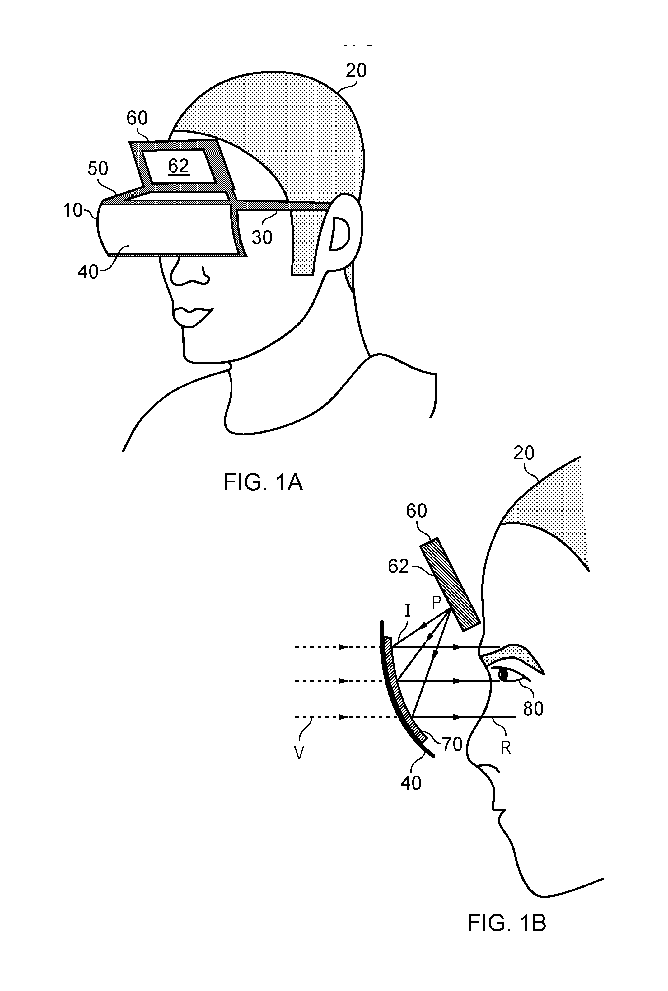 Head mountable device