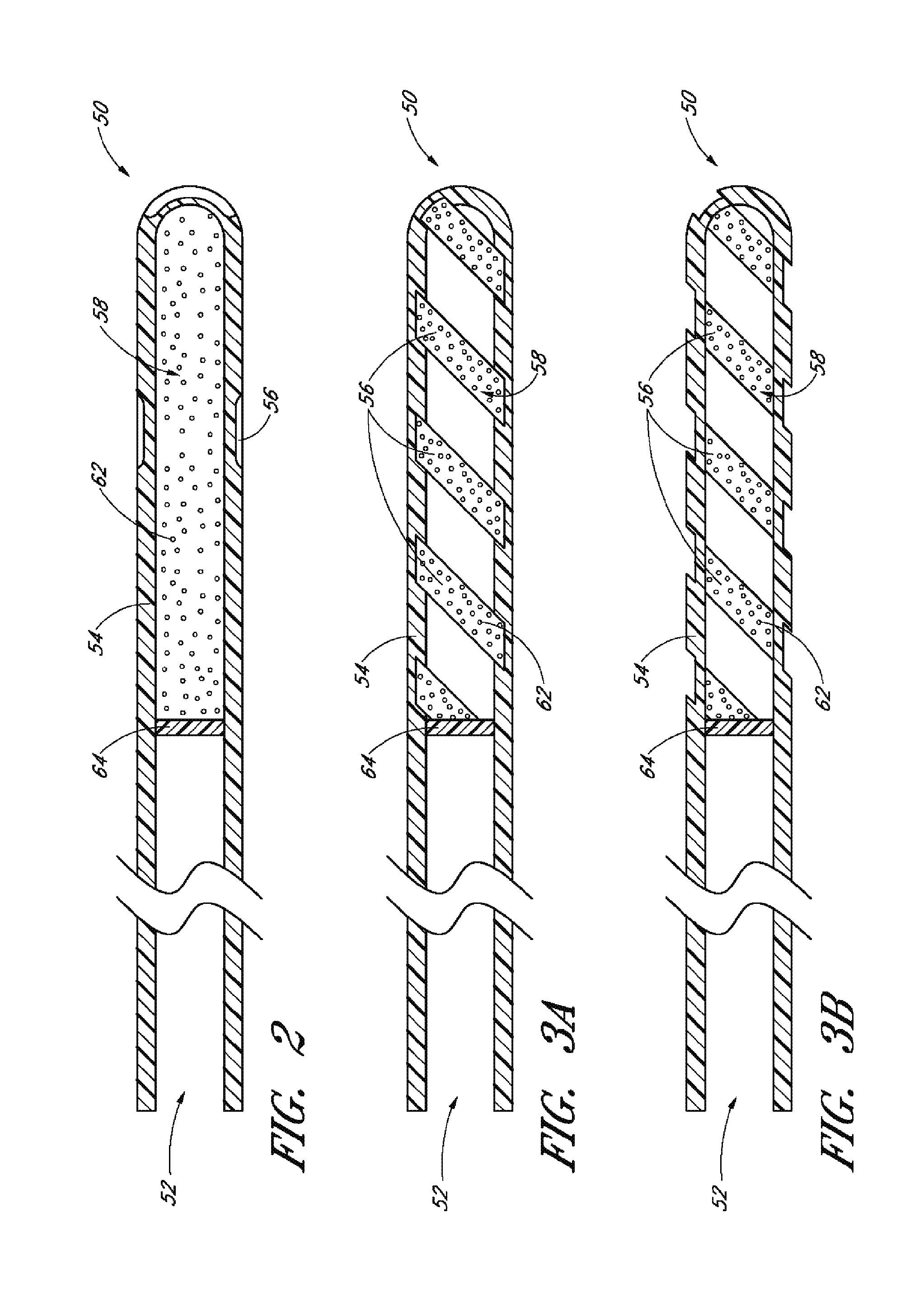 Implants with controlled drug delivery features and methods of using same
