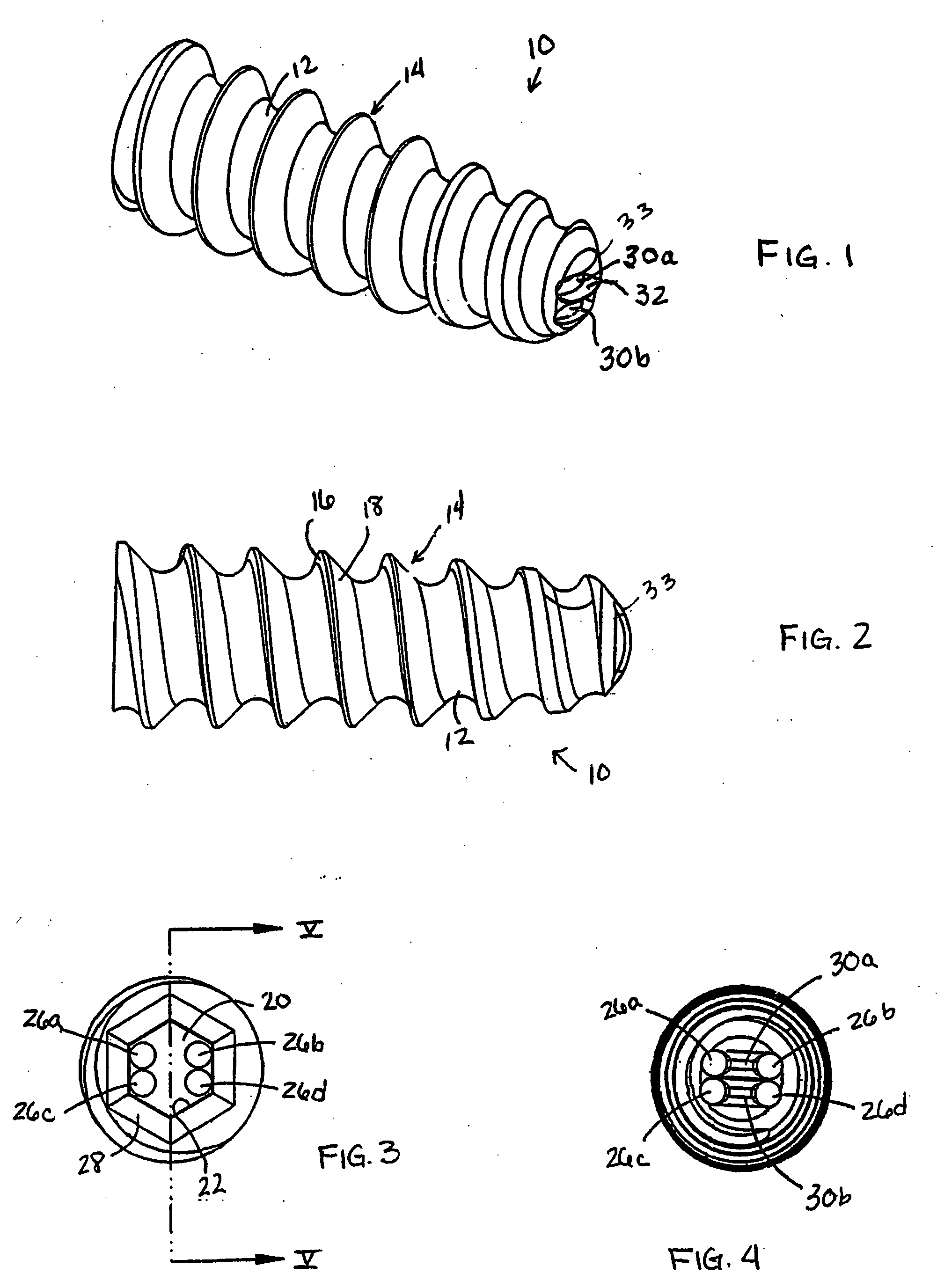 Suture anchor with apertures at tip
