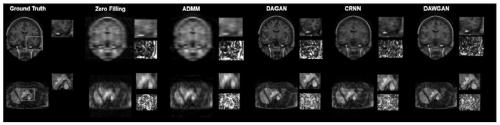 Magnetic resonance imaging method and device based on generative adversarial network