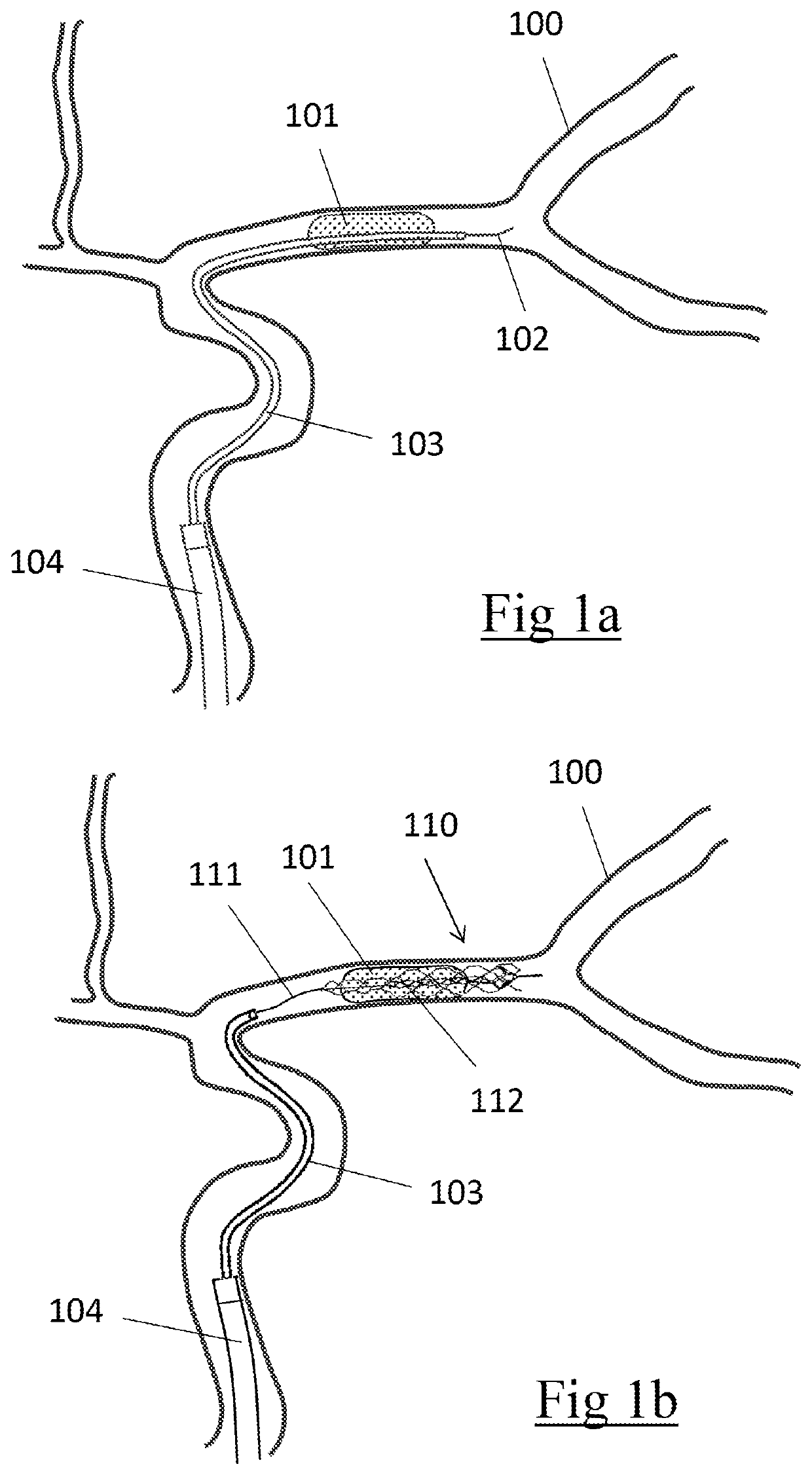 Clot retrieval device for removing clot from a blood vessel