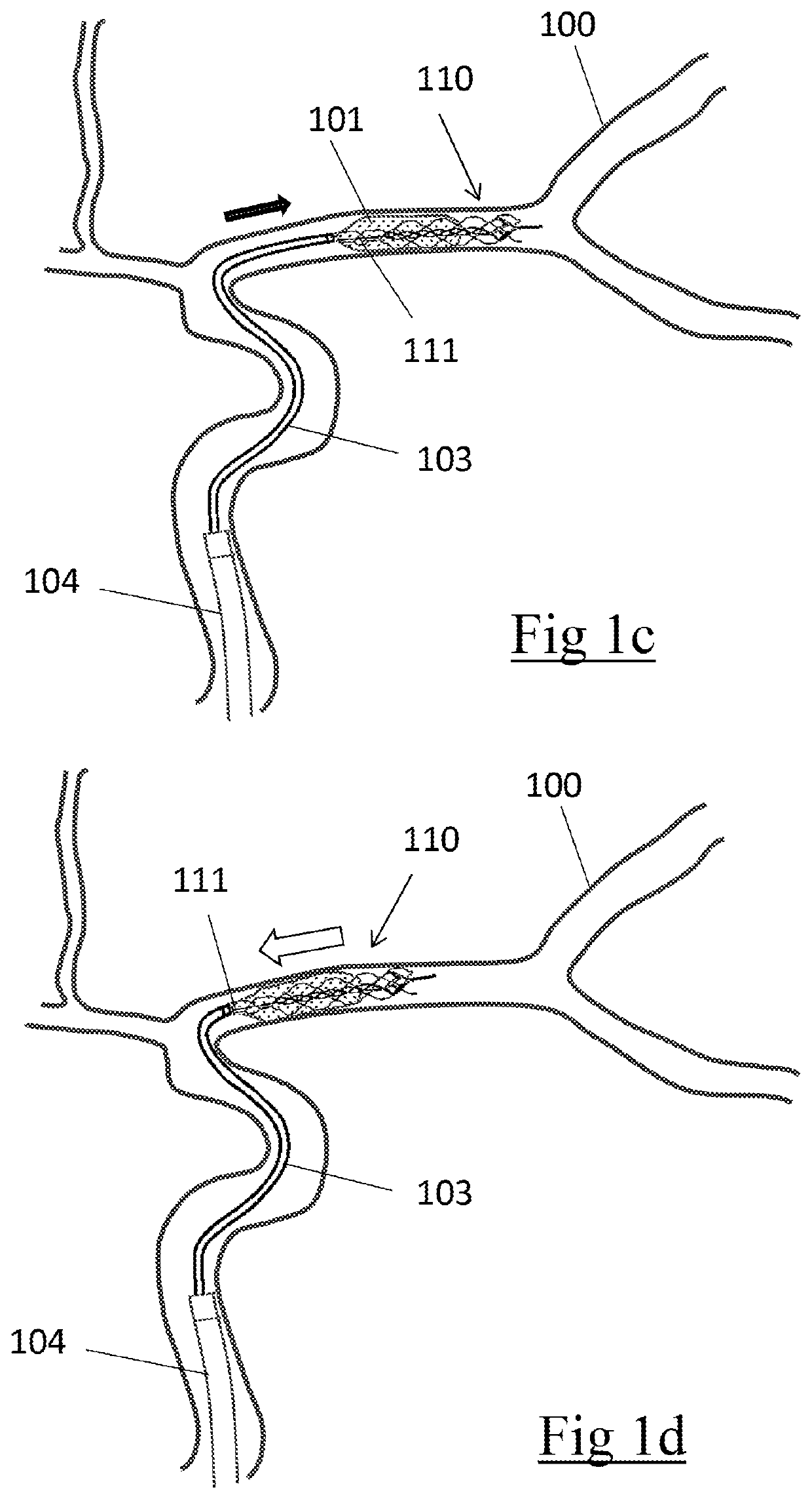 Clot retrieval device for removing clot from a blood vessel