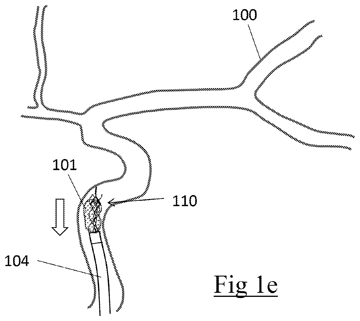 Clot retrieval device for removing clot from a blood vessel