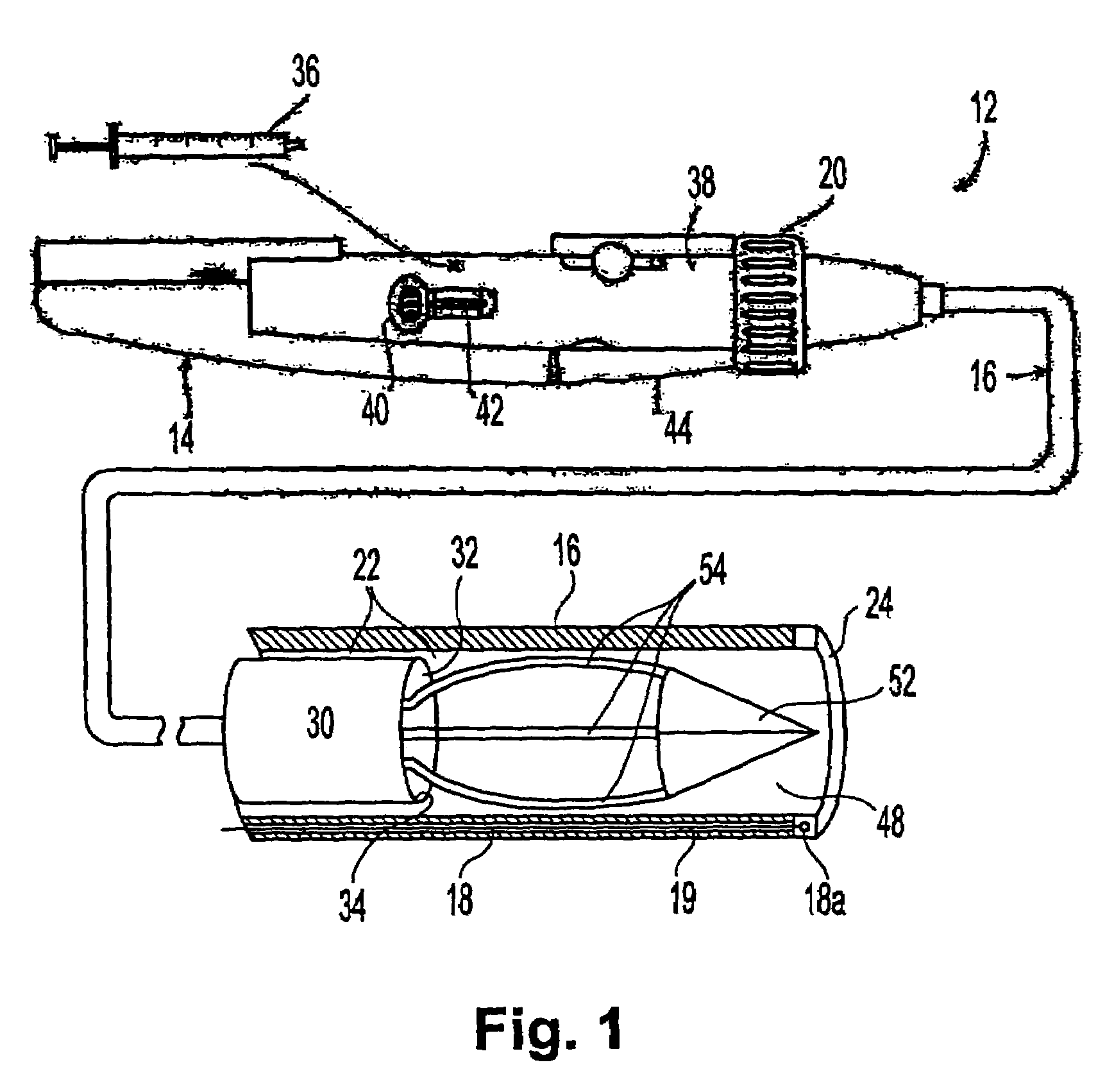 Apparatus and method for delivering therapeutic and diagnostic agents