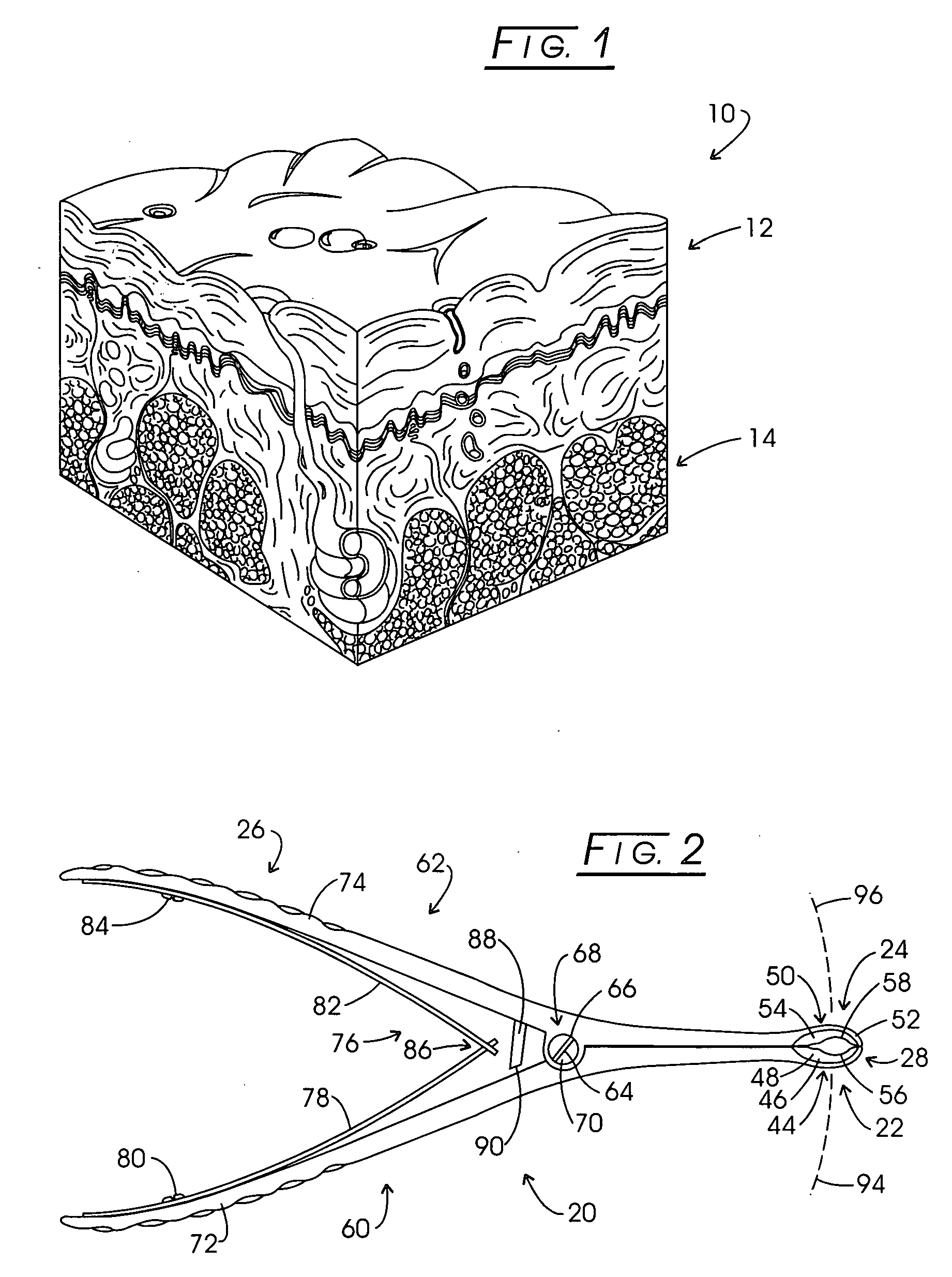 Method and apparatus for positioning a tissue recovery instrument in confronting adjacency with a target tissue volume