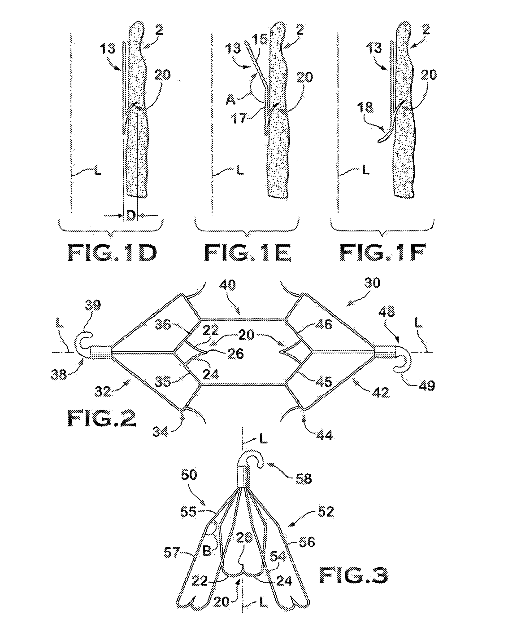 IVC Filter with Translating Hooks