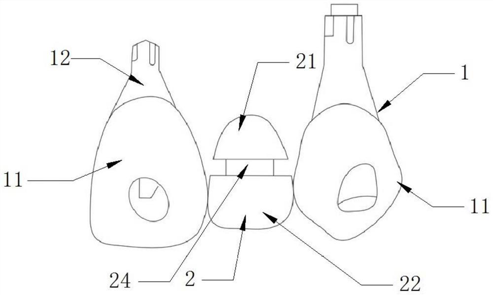 Gingival radian shaping device and preparation method thereof