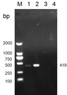 A set of lamp detection primers and kits for microsporidia in silkworm eggs