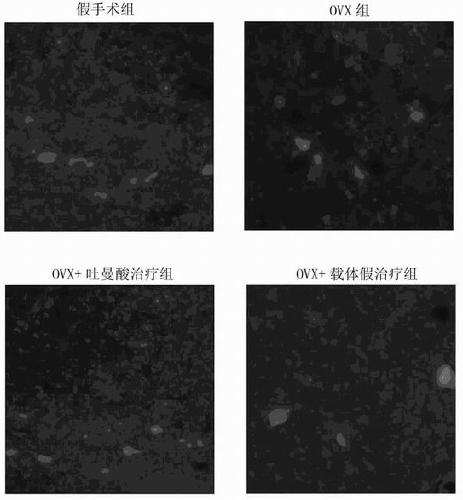 Application of tuccinic acid in the preparation of drugs for treating or preventing Alzheimer's disease caused by estrogen deficiency