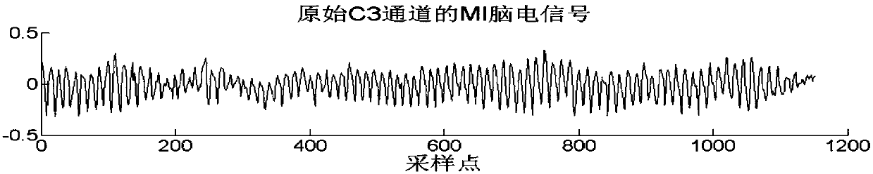 EEMD (Ensemble Empirical Mode Decomposition) and wavelet threshold based motor imagery electroencephalogram signal denoising method