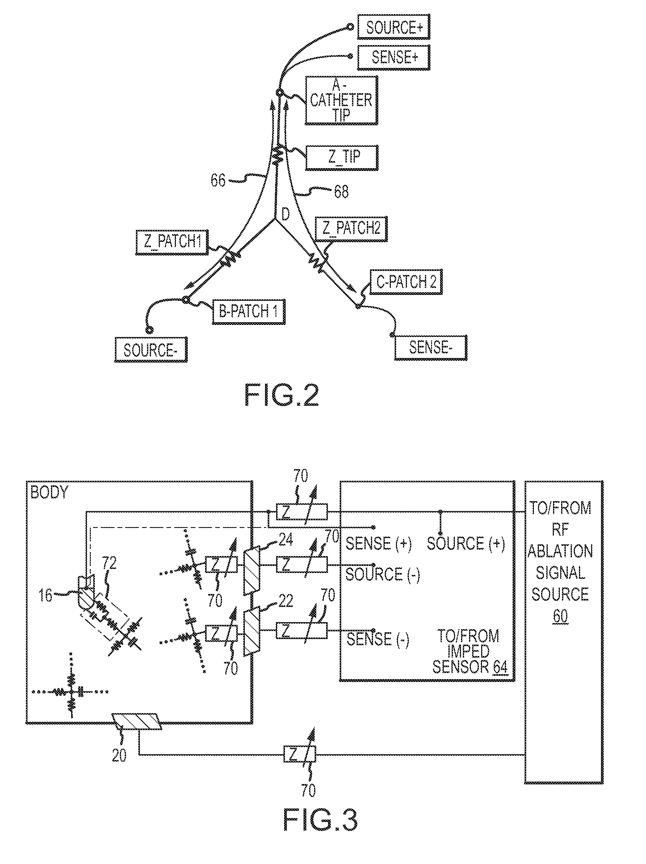 Graphical user interface for real-time RF lesion depth display