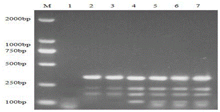 APP, M.hyo, PCV-2 and PRRSV multiplex PCR detection primer, kit and detection method