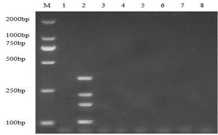 APP, M.hyo, PCV-2 and PRRSV multiplex PCR detection primer, kit and detection method