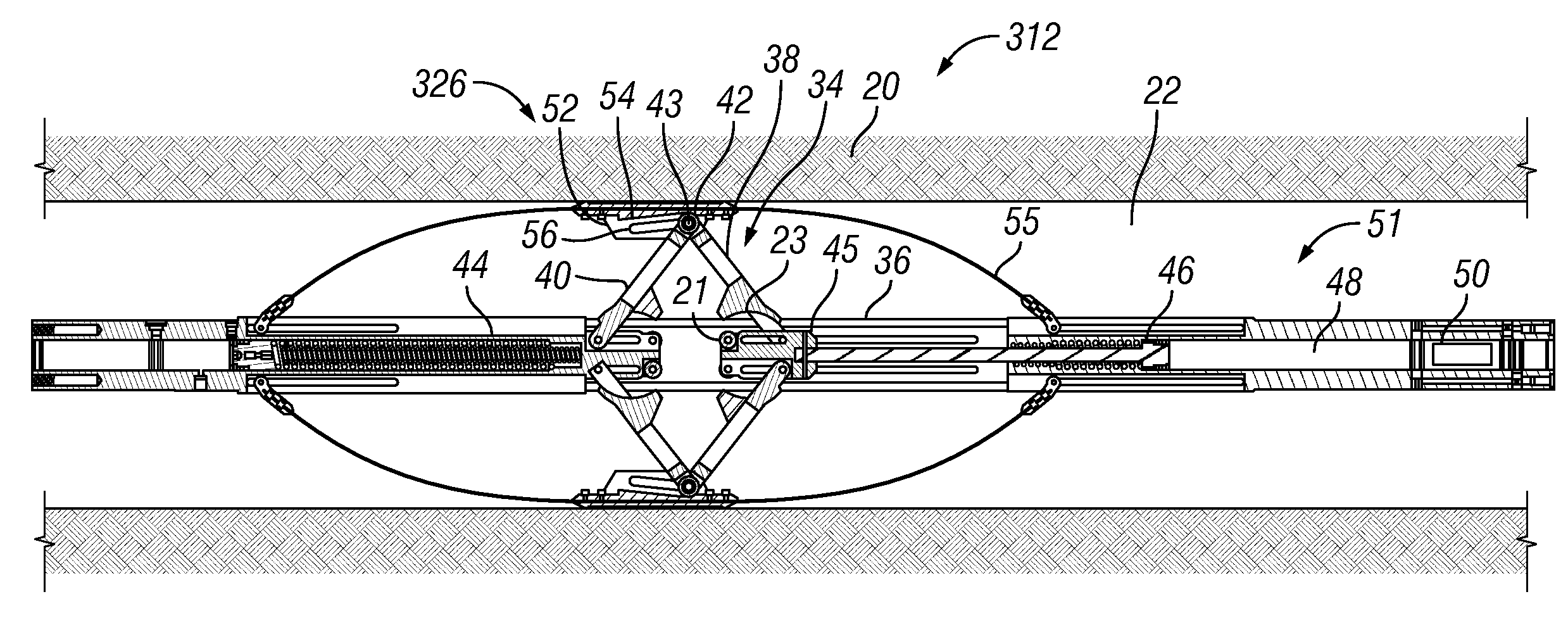 Self-anchoring device with force amplification