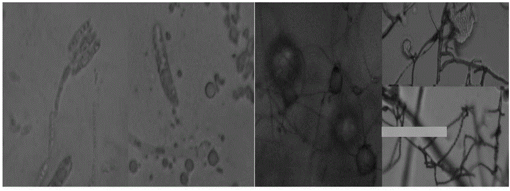 A gibberella strain and its application in the preparation of rutin and quercetin