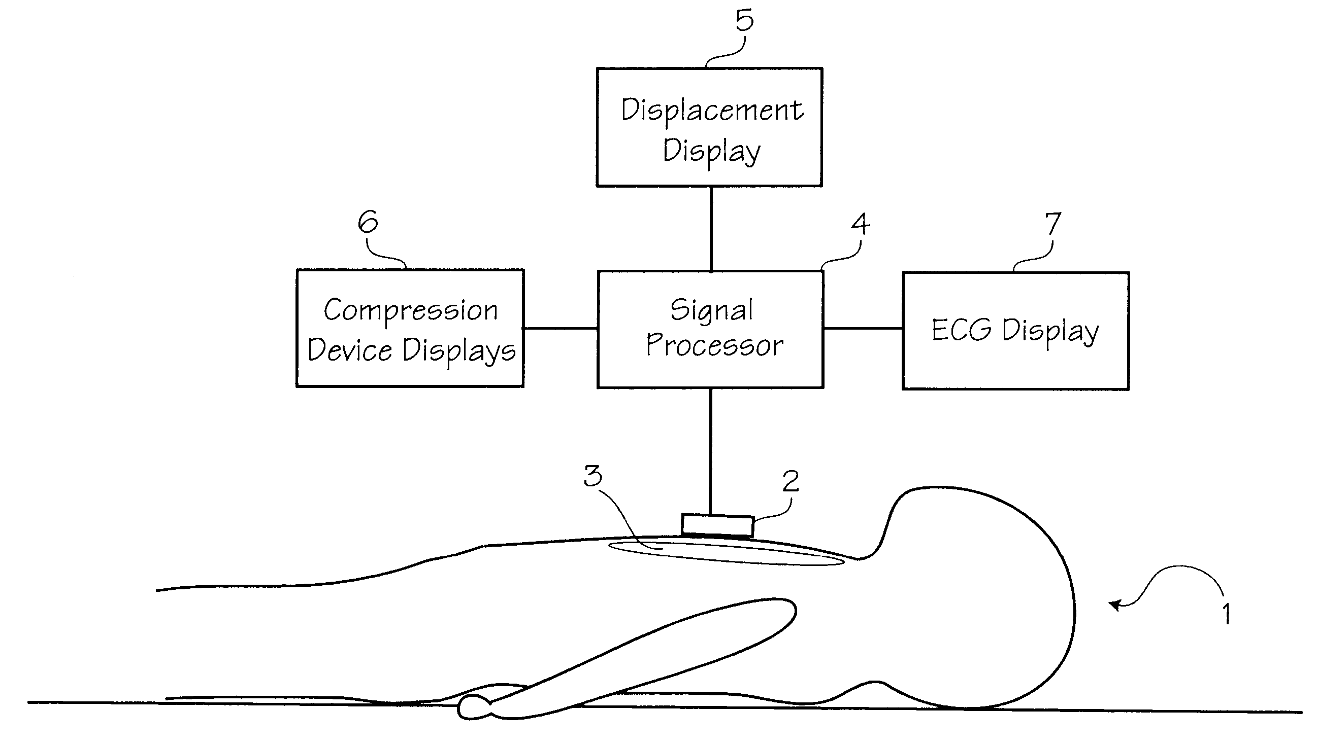Method of determining depth of compressions during cardio-pulmonary resuscitation